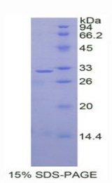 DKK1 Protein - Recombinant Dickkopf Related Protein 1 By SDS-PAGE