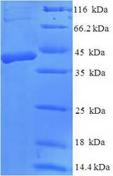 DKK2 Protein