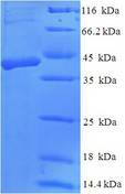 DKK2 Protein