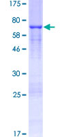 DKK3 Protein - 12.5% SDS-PAGE of human DKK3 stained with Coomassie Blue
