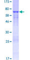 DKK3 Protein - 12.5% SDS-PAGE of human DKK3 stained with Coomassie Blue