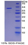 DKK3 Protein - Recombinant  Dickkopf Related Protein 3 By SDS-PAGE