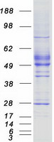 DKK3 Protein - Purified recombinant protein DKK3 was analyzed by SDS-PAGE gel and Coomassie Blue Staining