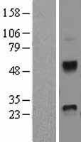 DKK4 Protein - Western validation with an anti-DDK antibody * L: Control HEK293 lysate R: Over-expression lysate