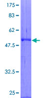 DKK4 Protein - 12.5% SDS-PAGE of human DKK4 stained with Coomassie Blue