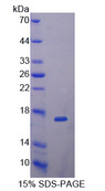 DKK4 Protein - Recombinant  Dickkopf Related Protein 4 By SDS-PAGE
