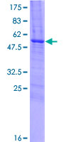 DKKL1 / Soggy-1 Protein - 12.5% SDS-PAGE of human DKKL1 stained with Coomassie Blue