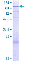 DLAT / PDC-E2 Protein - 12.5% SDS-PAGE of human DLAT stained with Coomassie Blue