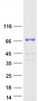 DLAT / PDC-E2 Protein - Purified recombinant protein DLAT was analyzed by SDS-PAGE gel and Coomassie Blue Staining