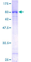DLD / Diaphorase / E3 Protein - 12.5% SDS-PAGE of human DLD stained with Coomassie Blue