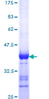 DLG1 / SAP97 Protein - 12.5% SDS-PAGE Stained with Coomassie Blue.