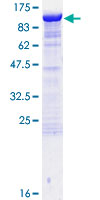 DLG3 / SAP102 Protein - 12.5% SDS-PAGE of human DLG3 stained with Coomassie Blue