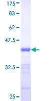 DLG3 / SAP102 Protein - 12.5% SDS-PAGE Stained with Coomassie Blue.