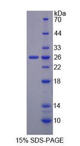 DLG3 / SAP102 Protein - Recombinant Discs, Large Homolog 3 By SDS-PAGE