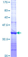 DLG5 Protein - 12.5% SDS-PAGE Stained with Coomassie Blue