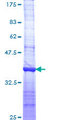 DLG5 Protein - 12.5% SDS-PAGE Stained with Coomassie Blue