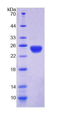 DLG5 Protein - Recombinant Discs, Large Homolog 5 (DLG5) by SDS-PAGE