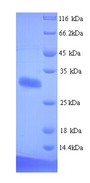 DLK1 / Pref-1 Protein