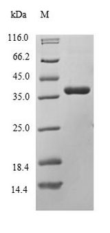 DLK1 / Pref-1 Protein - (Tris-Glycine gel) Discontinuous SDS-PAGE (reduced) with 5% enrichment gel and 15% separation gel.