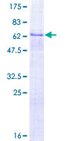 DLK1 / Pref-1 Protein - 12.5% SDS-PAGE of human DLK1 stained with Coomassie Blue