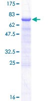DLK2 Protein - 12.5% SDS-PAGE of human DLK2 stained with Coomassie Blue