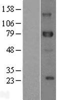 DLL1 Protein - Western validation with an anti-DDK antibody * L: Control HEK293 lysate R: Over-expression lysate