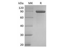 DLL1 Protein - Recombinant Human Delta-like Protein 1/DLL1 (C-Fc)