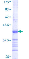 DLST / E2 Protein - 12.5% SDS-PAGE Stained with Coomassie Blue.