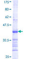 DLST / E2 Protein - 12.5% SDS-PAGE Stained with Coomassie Blue.