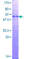 DLX1 Protein - 12.5% SDS-PAGE of human DLX1 stained with Coomassie Blue