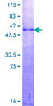 DLX1 Protein - 12.5% SDS-PAGE of human DLX1 stained with Coomassie Blue