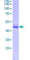 DLX2 Protein - 12.5% SDS-PAGE Stained with Coomassie Blue