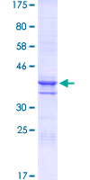 DLX2 Protein - 12.5% SDS-PAGE Stained with Coomassie Blue.