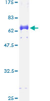DLX3 Protein - 12.5% SDS-PAGE of human DLX3 stained with Coomassie Blue