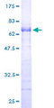 DLX3 Protein - 12.5% SDS-PAGE of human DLX3 stained with Coomassie Blue