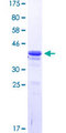 DLX5 Protein - 12.5% SDS-PAGE Stained with Coomassie Blue.