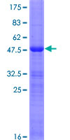 DLX6 Protein - 12.5% SDS-PAGE of human DLX6 stained with Coomassie Blue