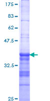 DLX6 Protein - 12.5% SDS-PAGE Stained with Coomassie Blue.