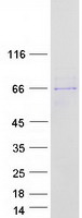 DMAP1 Protein - Purified recombinant protein DMAP1 was analyzed by SDS-PAGE gel and Coomassie Blue Staining