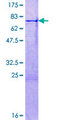 DMBX1 / OTX3 Protein - 12.5% SDS-PAGE of human DMBX1 stained with Coomassie Blue