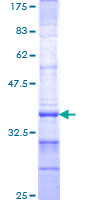 DMBX1 / OTX3 Protein - 12.5% SDS-PAGE Stained with Coomassie Blue.