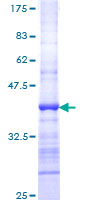 DMC1 Protein - 12.5% SDS-PAGE Stained with Coomassie Blue.