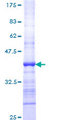 DMC1 Protein - 12.5% SDS-PAGE Stained with Coomassie Blue.