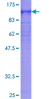 DMD / Dystrophin Protein - 12.5% SDS-PAGE of human DMD stained with Coomassie Blue