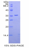 DMD / Dystrophin Protein - Recombinant Dystrophin By SDS-PAGE