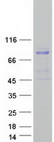 DMD / Dystrophin Protein - Purified recombinant protein DMD was analyzed by SDS-PAGE gel and Coomassie Blue Staining
