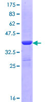 DMGDH Protein - 12.5% SDS-PAGE Stained with Coomassie Blue.