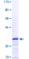 DMN / Desmuslin / Synemin Protein - 12.5% SDS-PAGE Stained with Coomassie Blue.