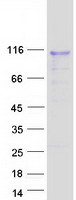 DMP1 Protein - Purified recombinant protein DMP1 was analyzed by SDS-PAGE gel and Coomassie Blue Staining