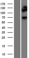 DMPK / DM Protein - Western validation with an anti-DDK antibody * L: Control HEK293 lysate R: Over-expression lysate